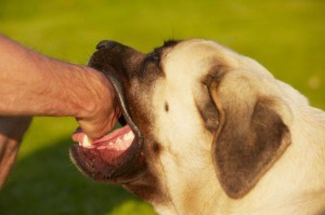 Dog-Biting-Mans-Hand-300×199