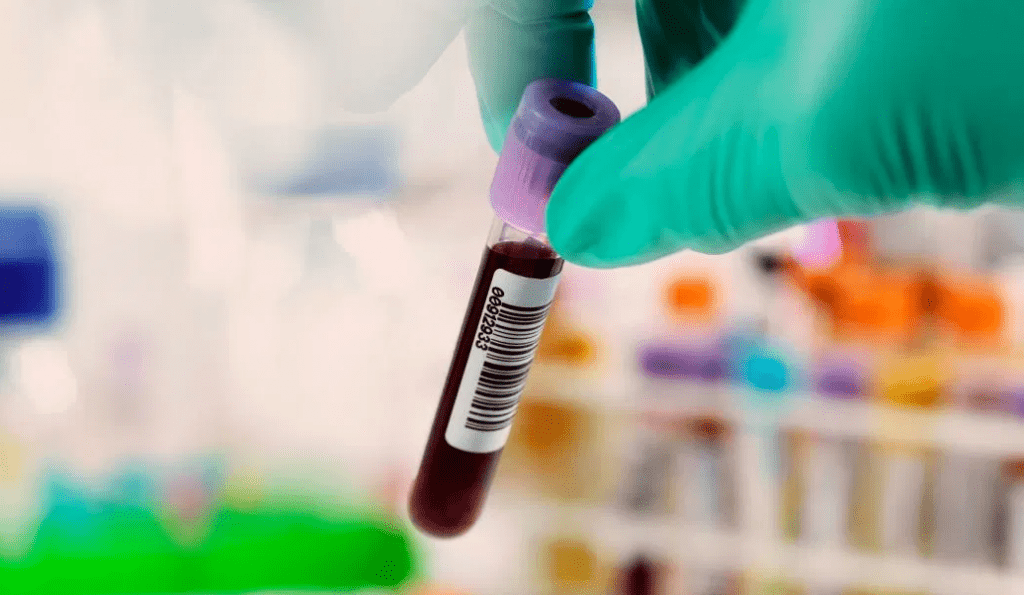 eprubeta-sange-1024x595.png eprubeta sange