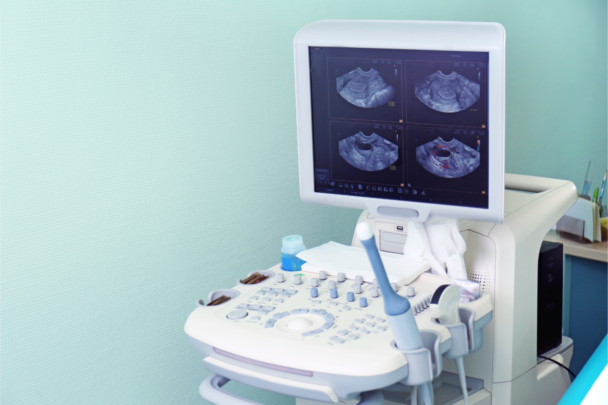 Analize medicale, radiografii și ecografii gratuite la Spitalul de Pneumoftiziologie Sibiu