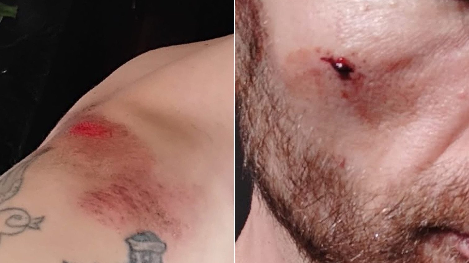 Un sibian îi acuză pe mai mulți polițiști de abuz, homofobie și agresiune