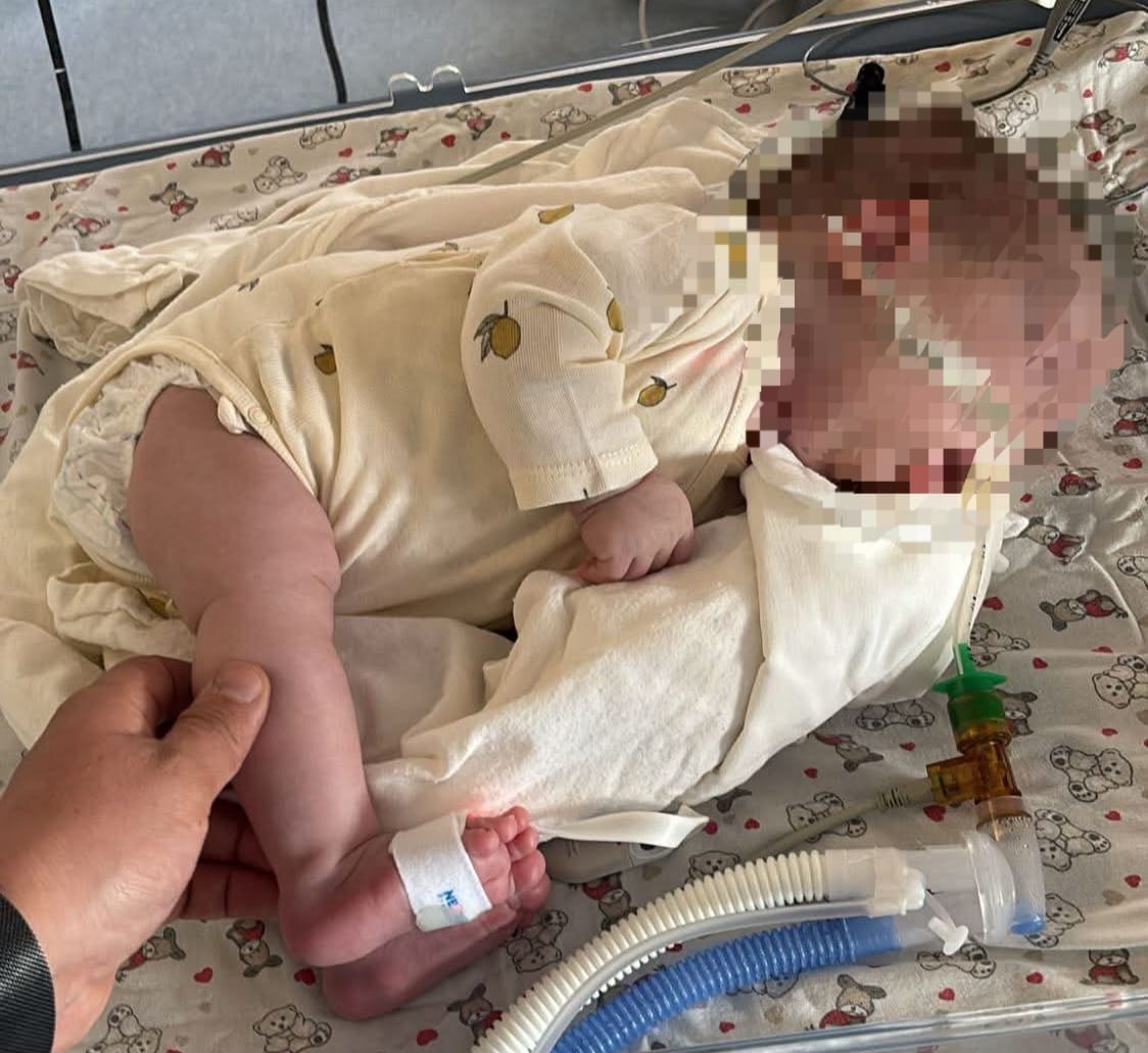 Micuța Ema-Ștefania, fetița polițistului care are nevoie de ajutor
