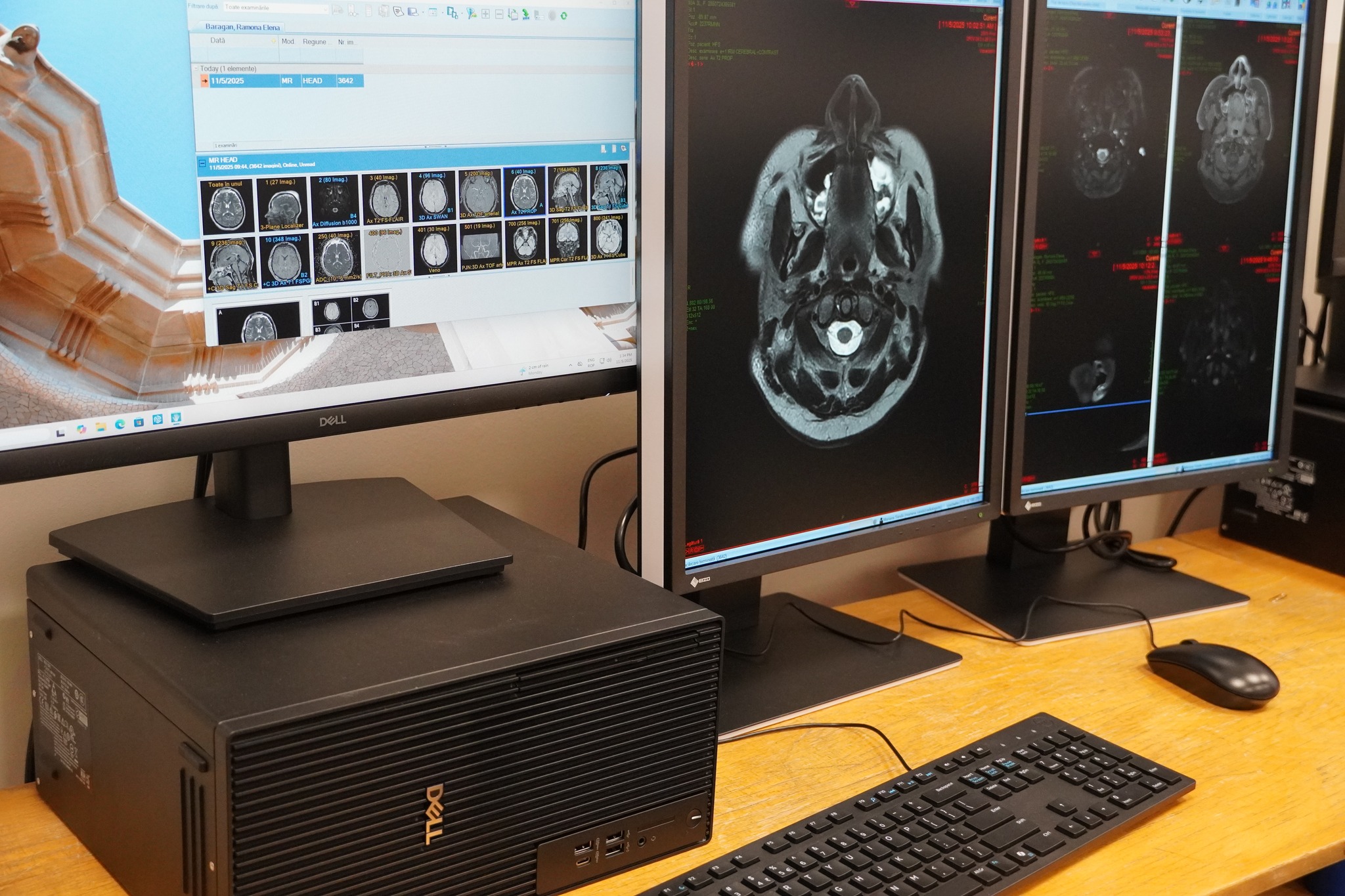 Servere și hardware de ultimă generație pentru Spitalul Clinic Județean de Urgență Sibiu.